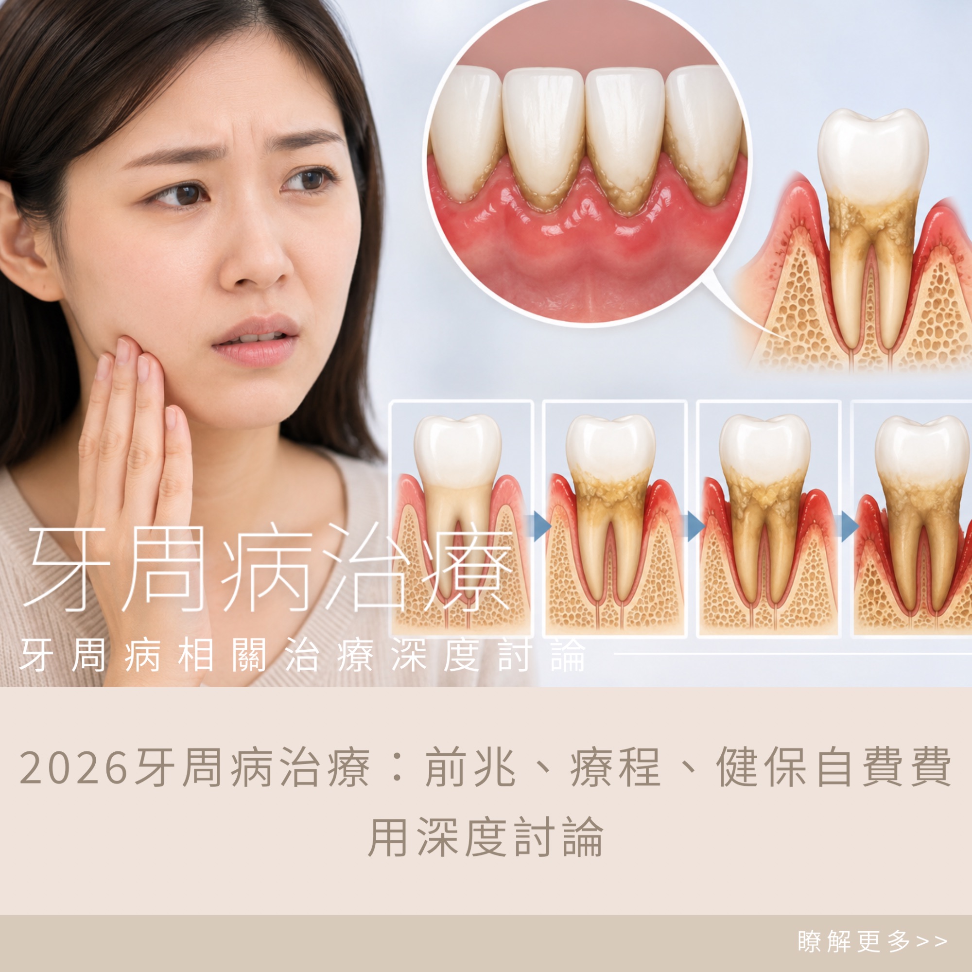 牙周病治療：前兆、療程、健保自費費用深度討論