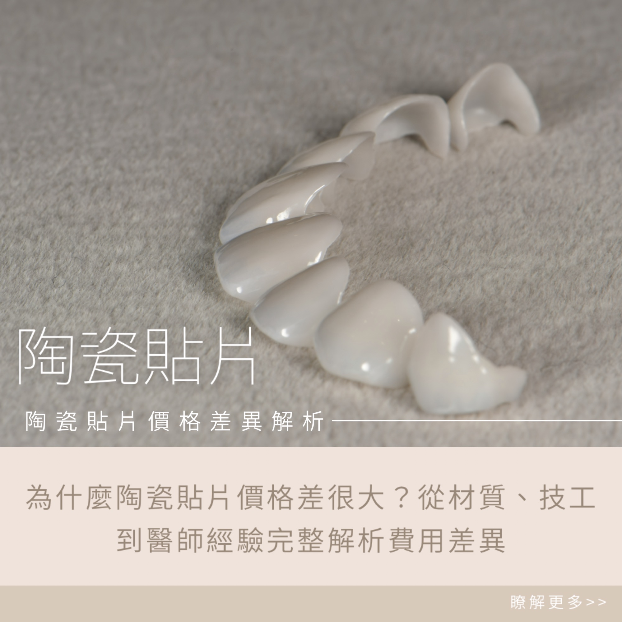 為什麼陶瓷貼片價格差很大?從材質、技工到醫師經驗完整解析費用差異
