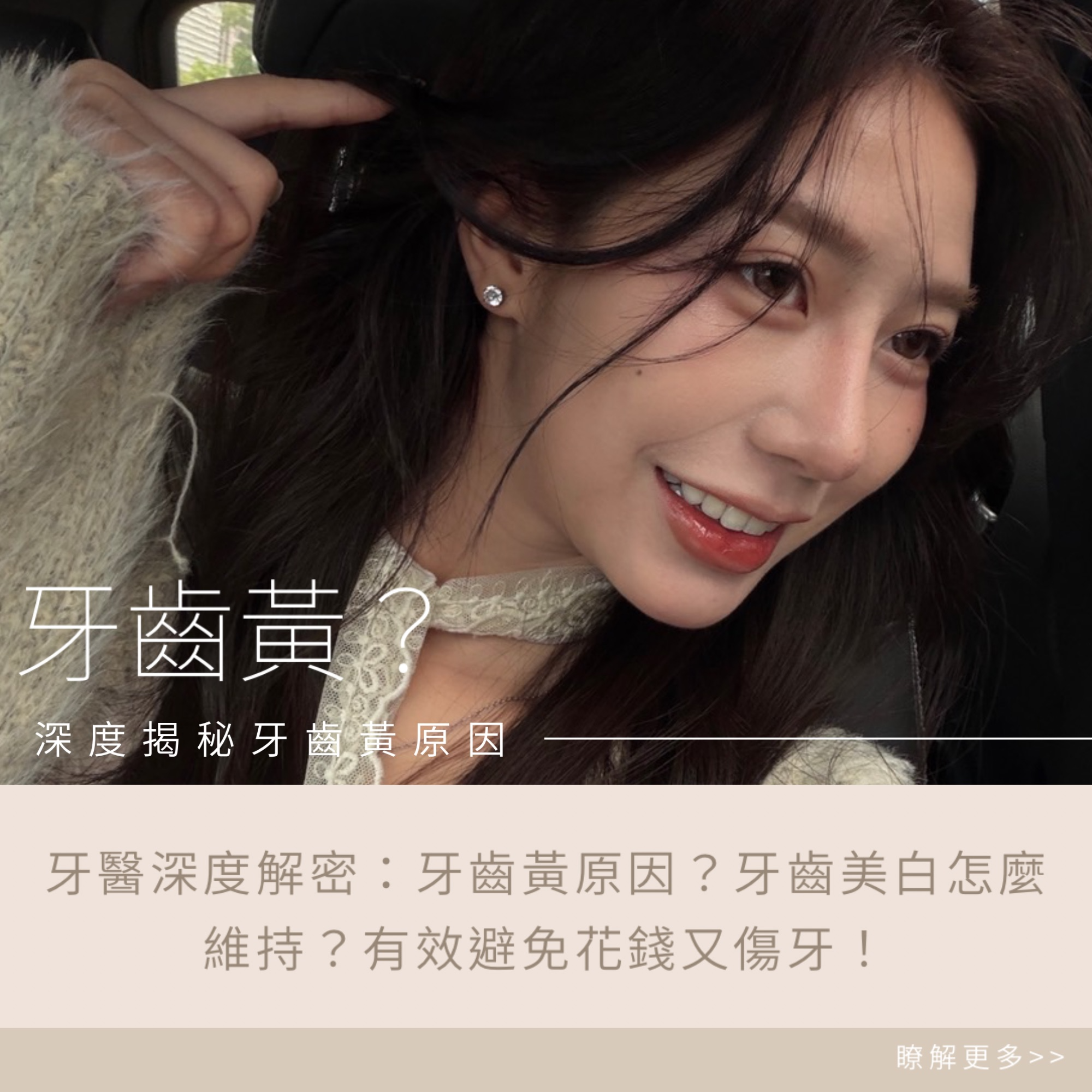 牙醫深度解密：牙齒黃原因？牙齒美白怎麼維持？有效避免花錢又傷牙！