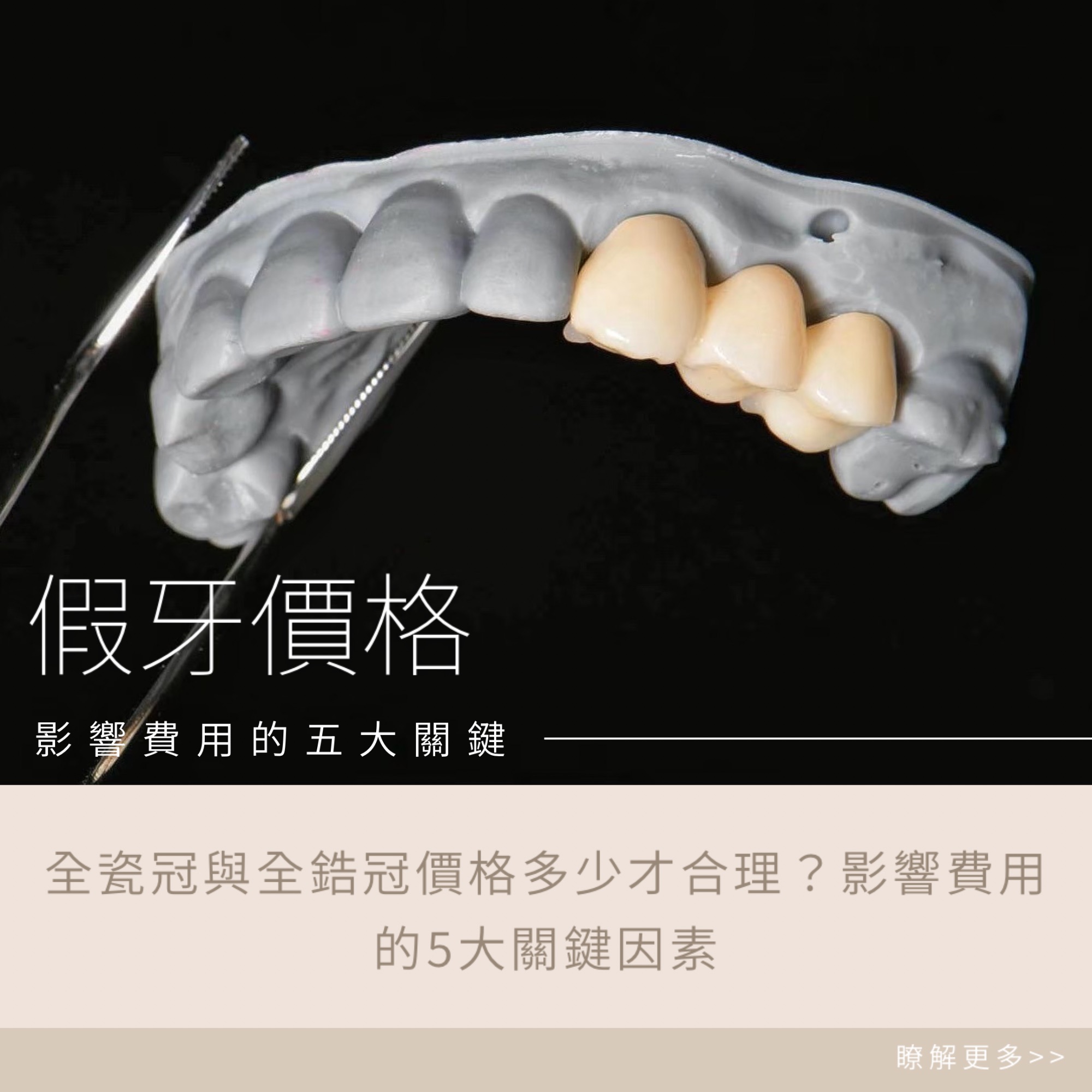 全瓷冠與全鋯冠價格多少才合理?影響費用的5大關鍵因素