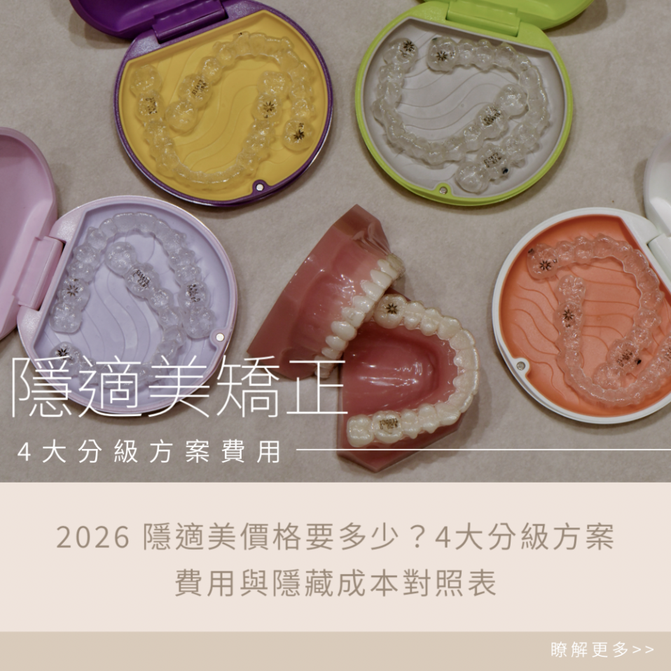 2026 隱適美價格要多少？4大分級方案費用與隱藏成本對照表