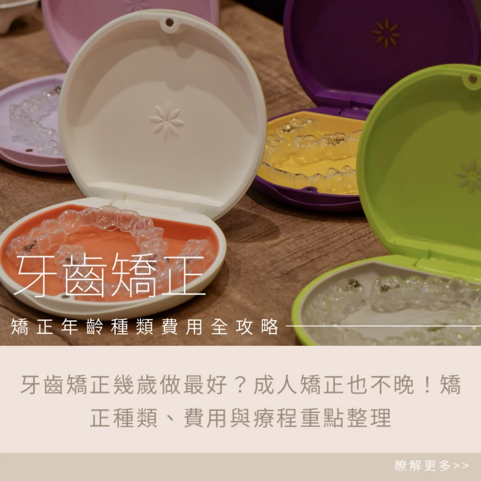 牙齒矯正幾歲做最好？成人矯正也不晚！矯正種類、費用與療程重點整理