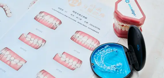 隱適美 Invisalign